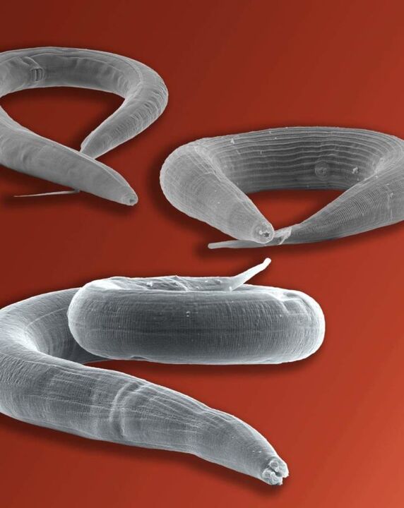 Pinworm